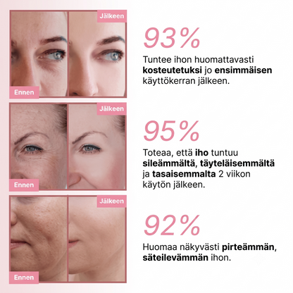PDRN-kollageenivolyymivoide 2.0